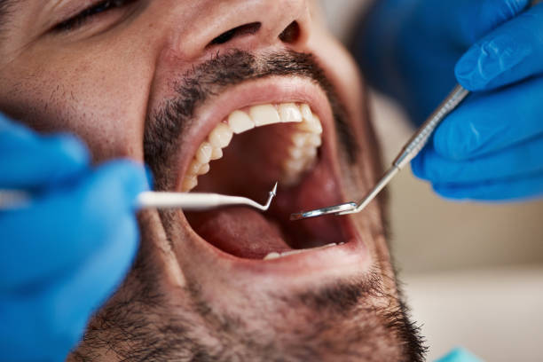 Best Urgent Dental Care for Toothaches in Fairmount Heights, MD